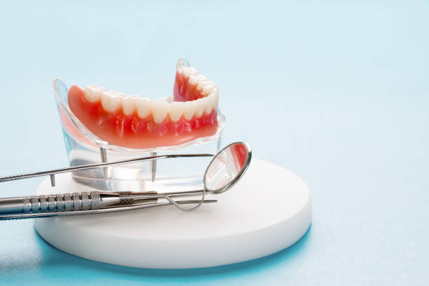 Dental Bonding in Linton, IN